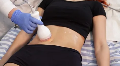 Body Contouring & Sculpting