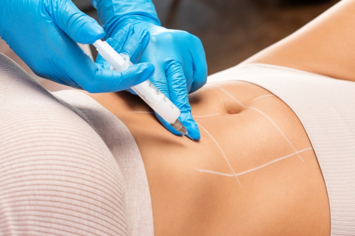 Continuous Glucose Monitoring Treatment at Live Light Clinic Mumbai