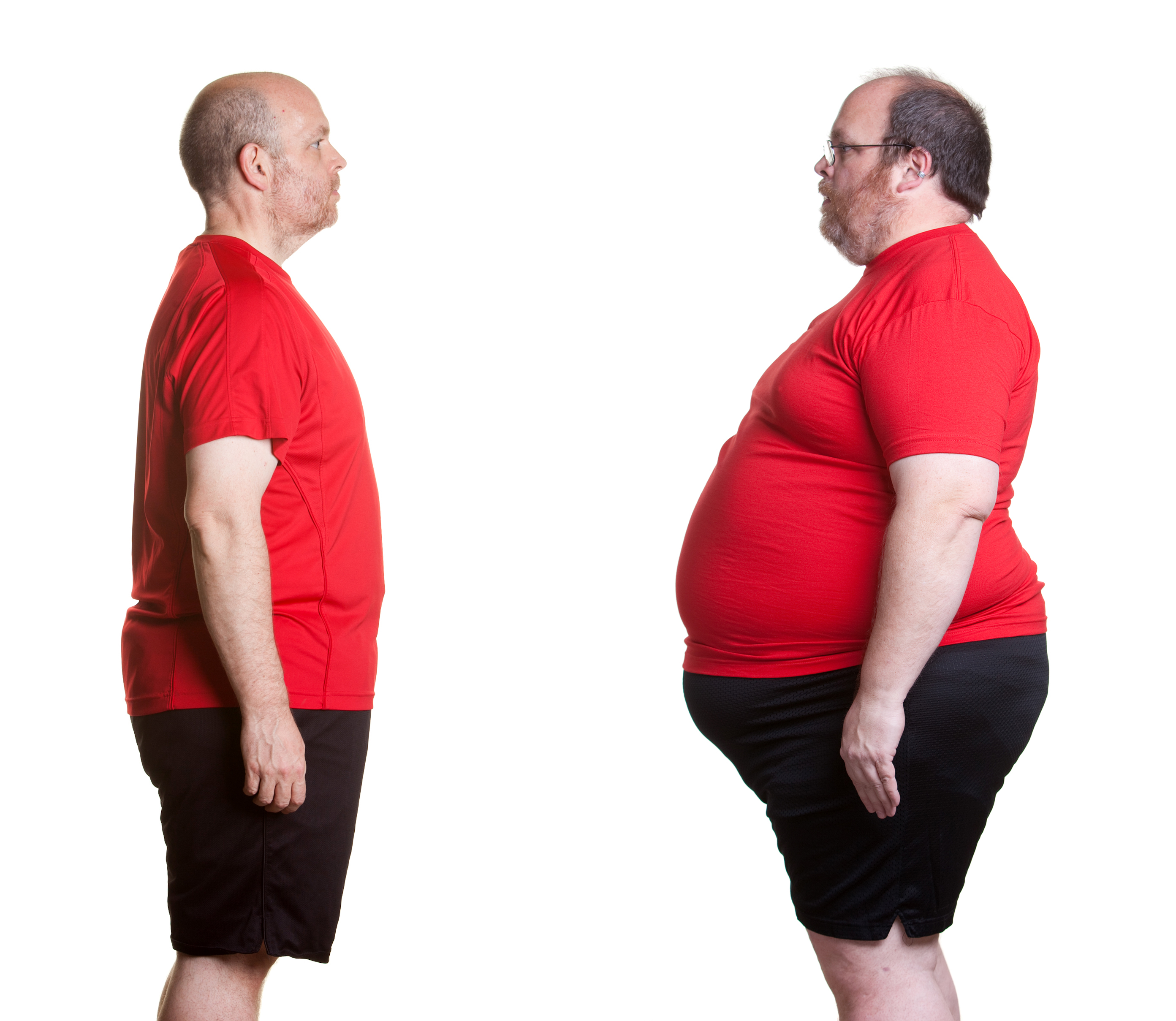 Obesity Causes